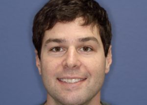 best dentist abington pa