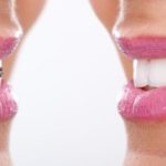 How to care for your braces