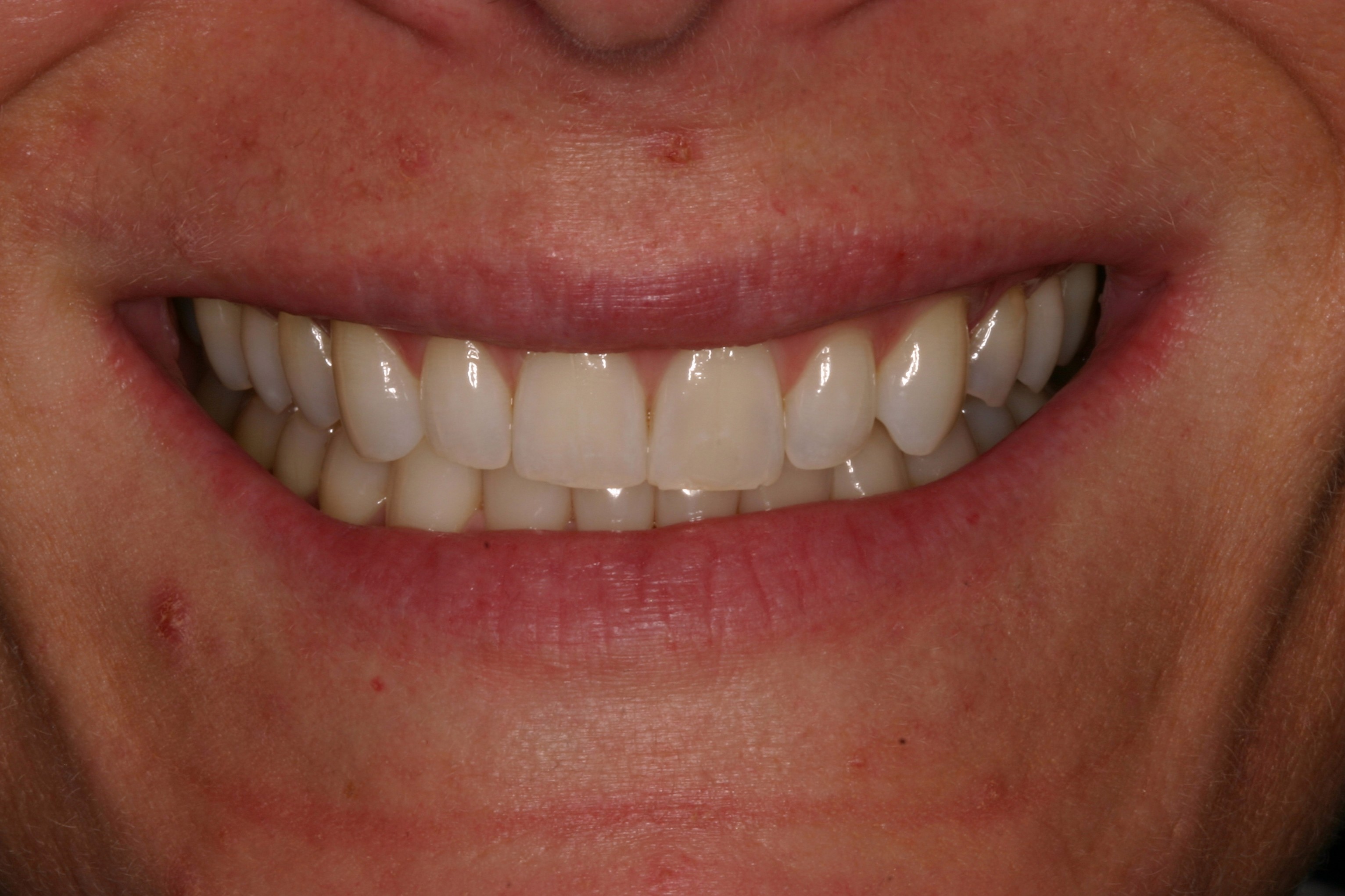 Neuromuscular dentistry philadelphia