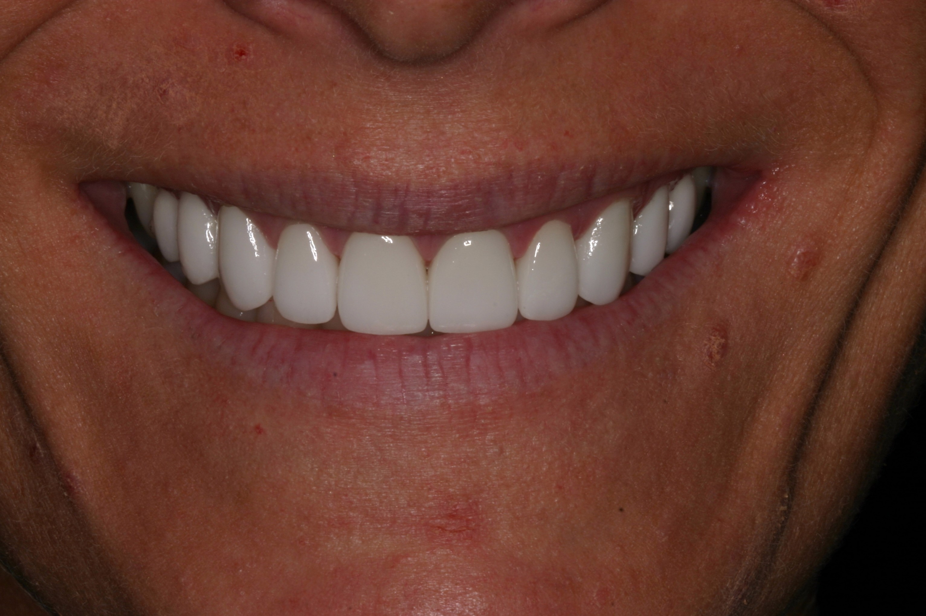 after neuromuscular dentistry abington pa