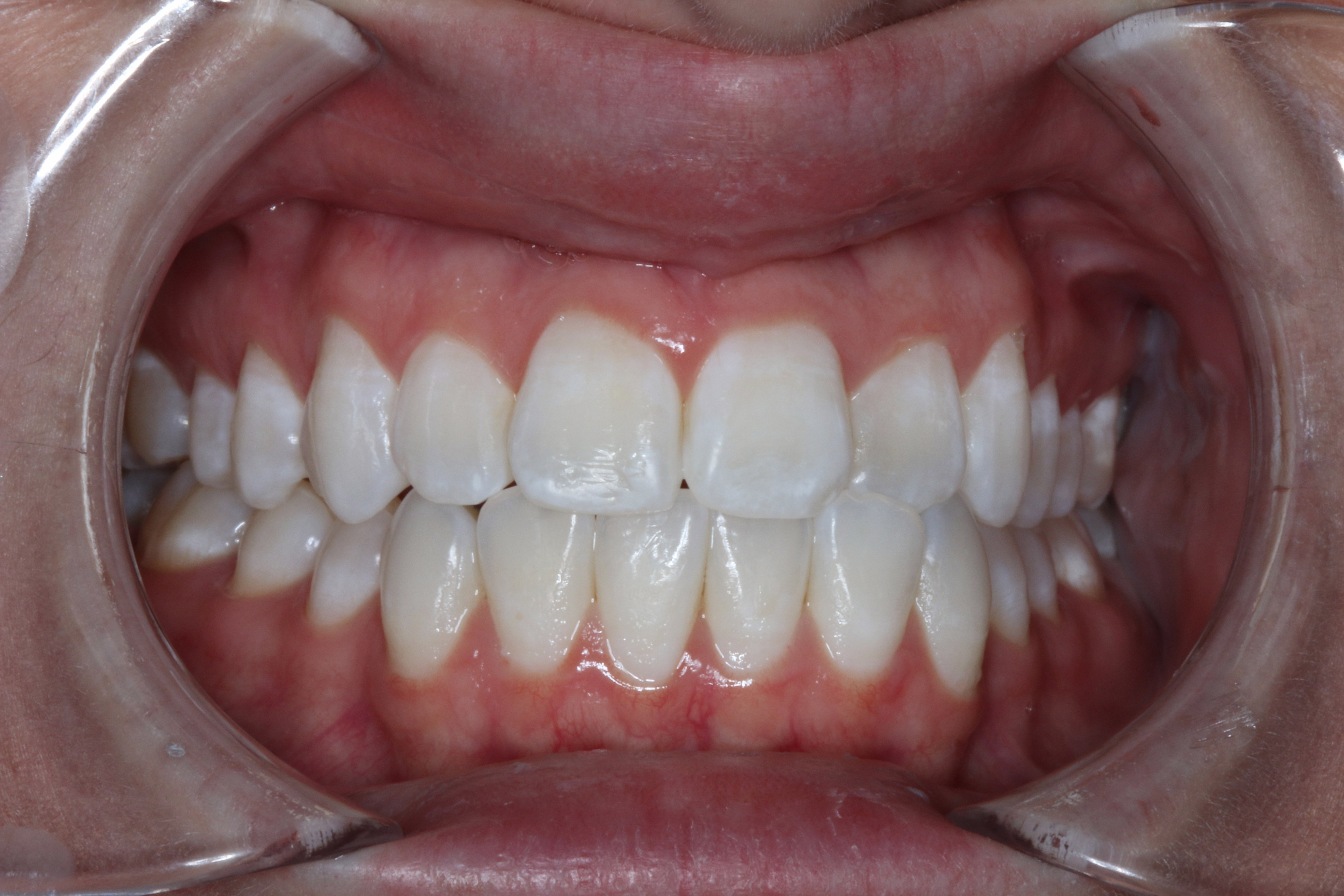 Neuromuscular dentistry philadelphia