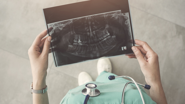 Doctor looking at an xray of mouth
