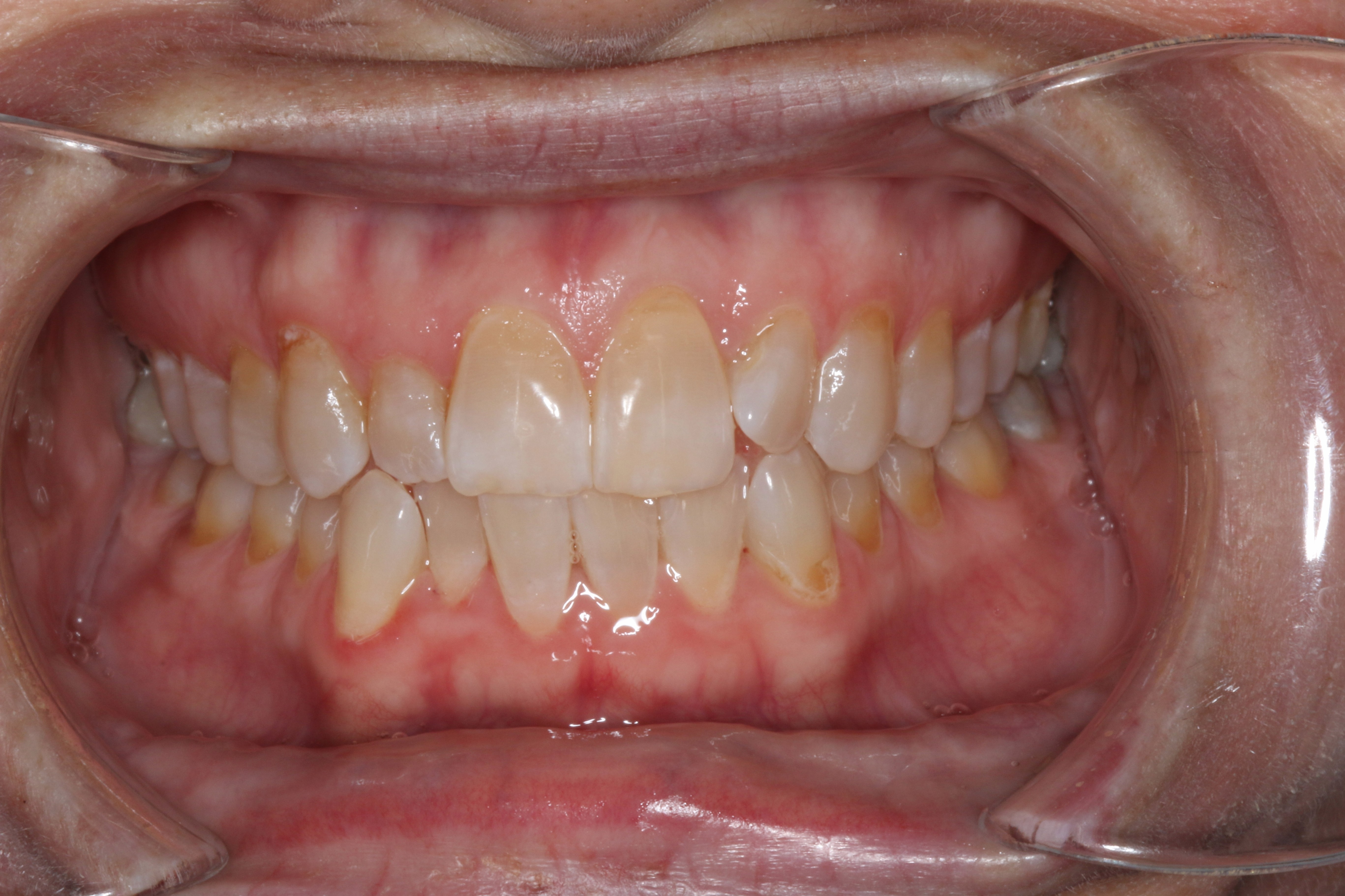 best dentist abington pa