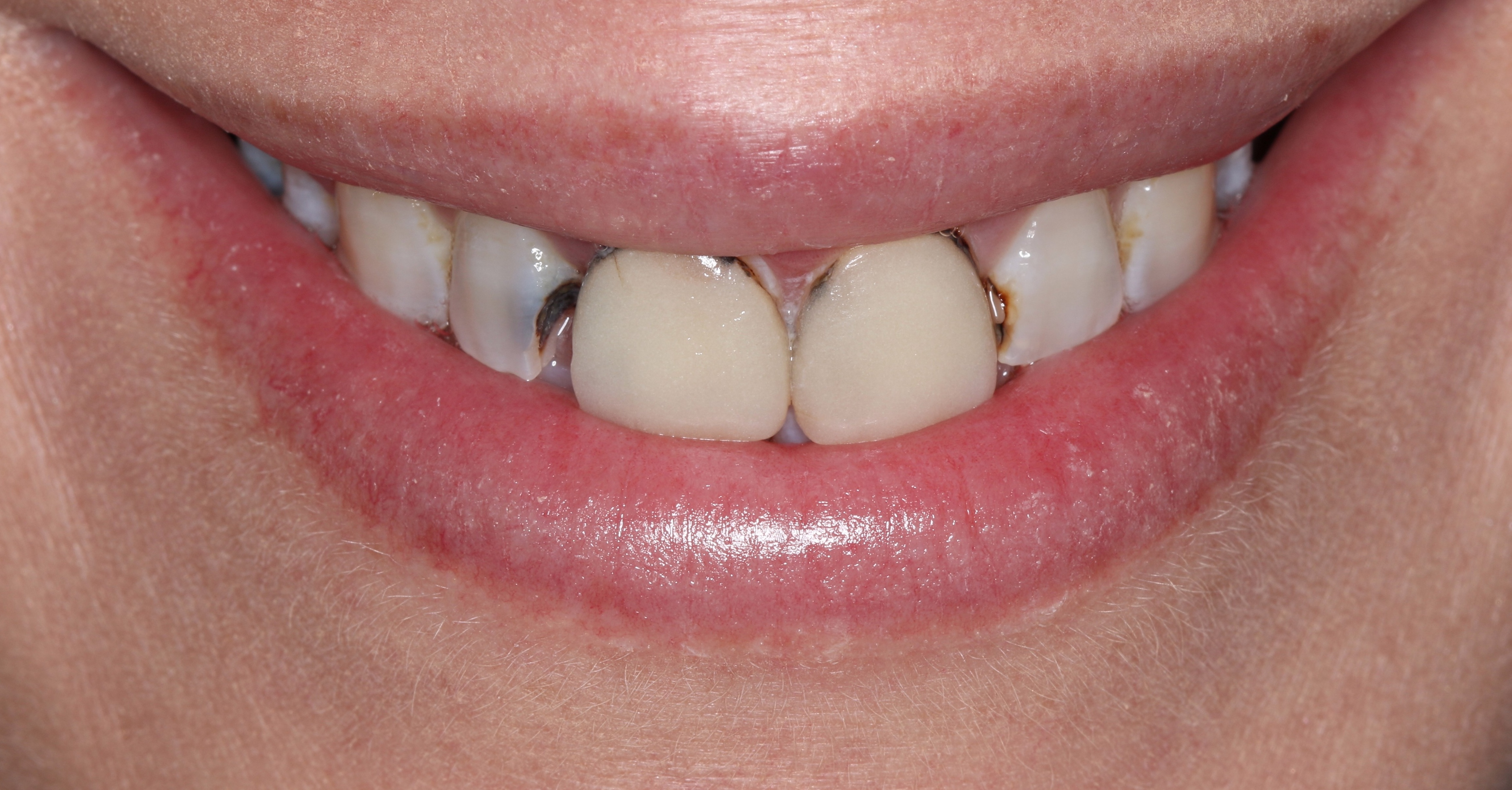 best dentist abington pa