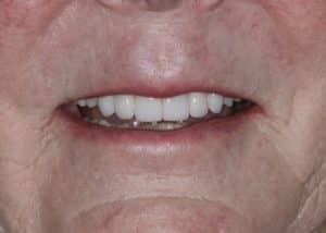 thumb_Dotty_after-2_1024-300x214-1