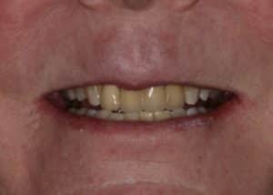 thumb_Dotty_before-2_1024-300x214-1