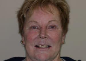 thumb_dotty_before_1024-300x214-1