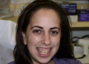 thumb_karen_before_1024-300x214-1